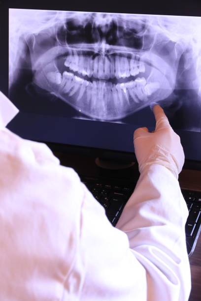 Best Emergency Treatment for Dental Infections or Abscesses in Tappan, NY